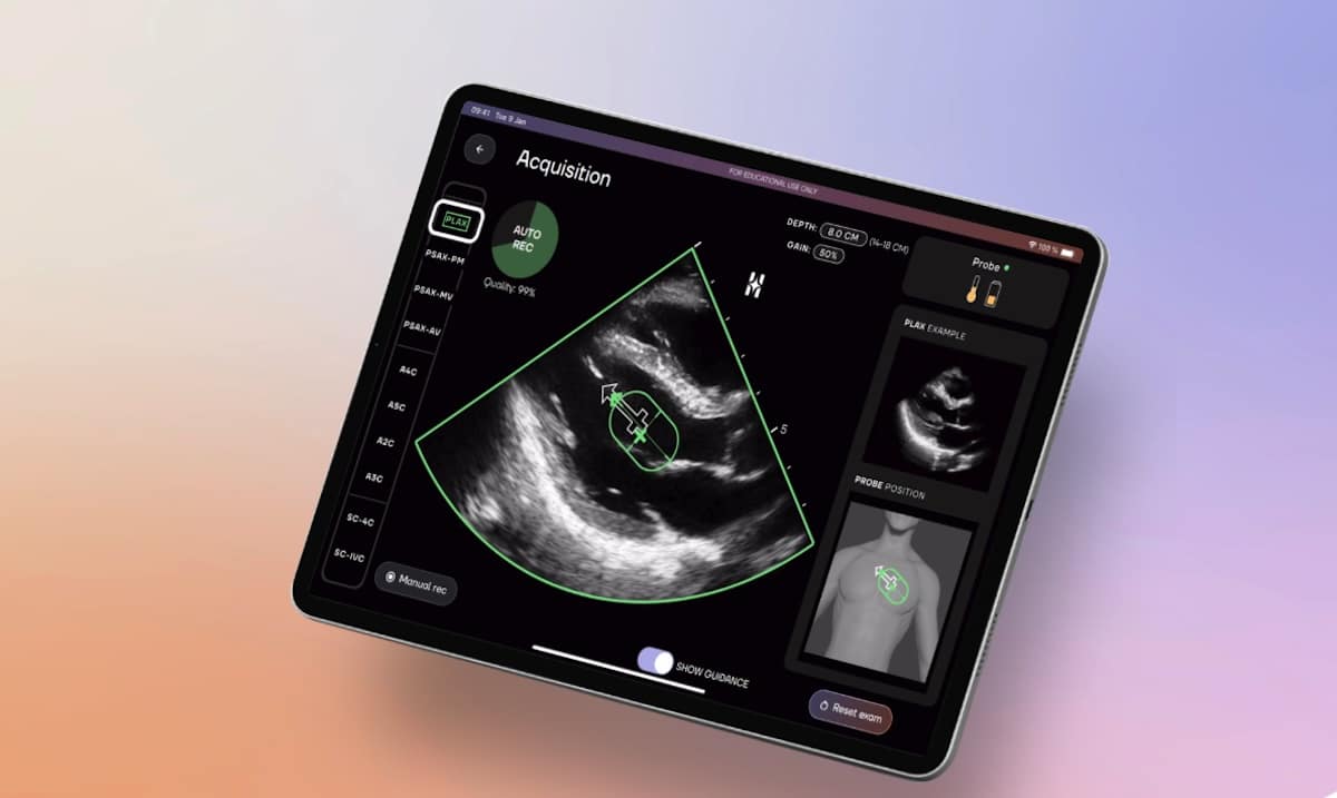 Bordeaux : Deski veut rendre l’échographie cardiaque universelle